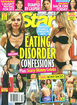 Illustration for article titled This Week in Tabloids: A Dubious and Fucked-Up Guide to Celebrity Eating Disorders